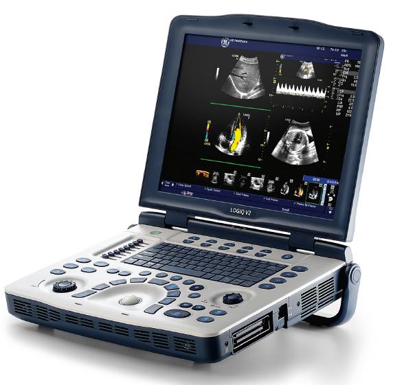 GE_logiq_V2_portable_ultrasound_machine