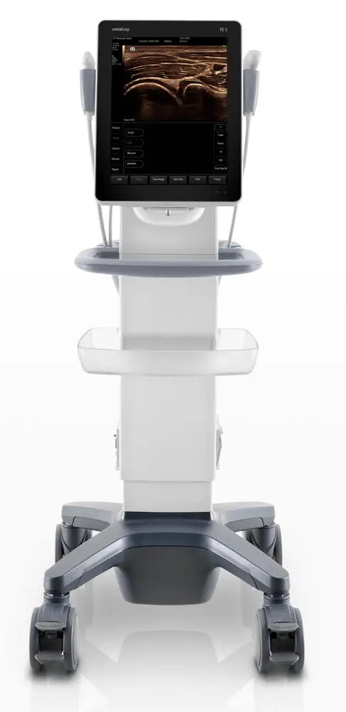 Mindray TE5 ultrasound system mounted on mobile cart for enhanced mobility in clinical environments