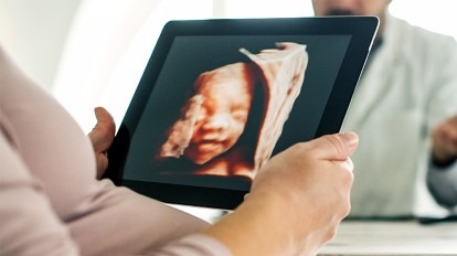 3D-and-4D-Ultrasounds-in-Pregnancy-tuss