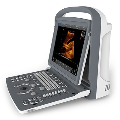 Chison Eco 2 – The Ultrasound Source