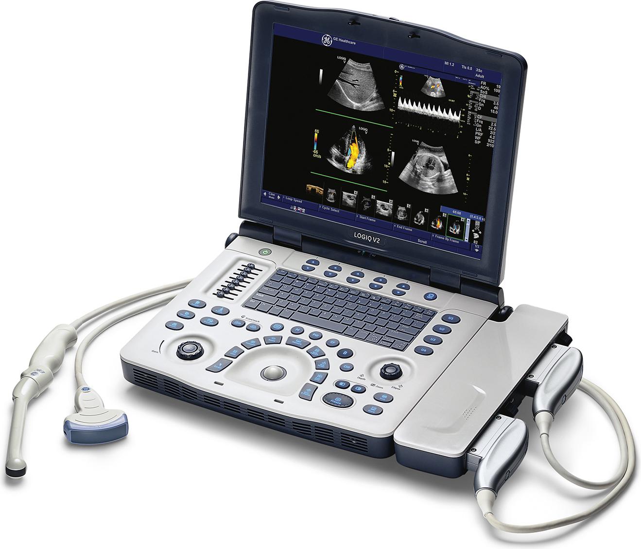 GE_V2_portable_ultrasound_machine_with_dual_transducer_probes