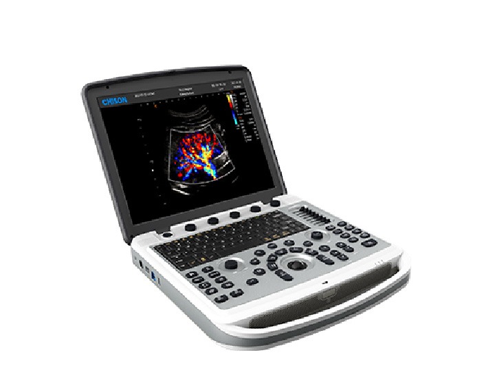 Chison Sonobook 6 – The Ultrasound Source