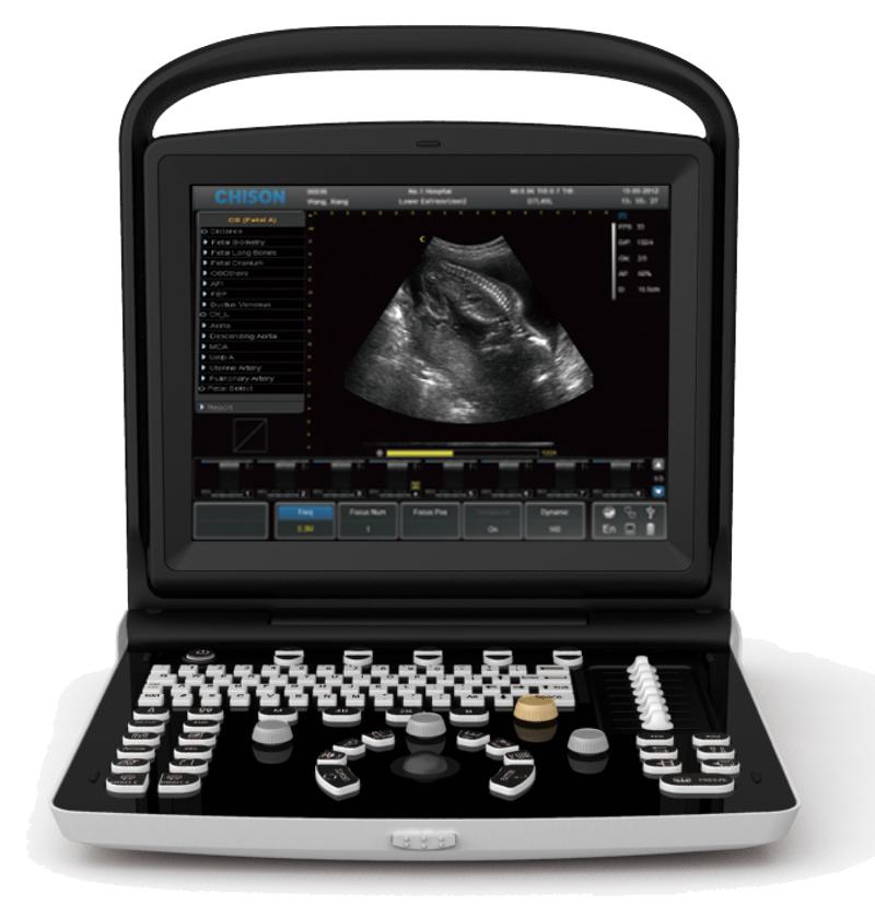 Chison Eco 3 Expert – The Ultrasound Source