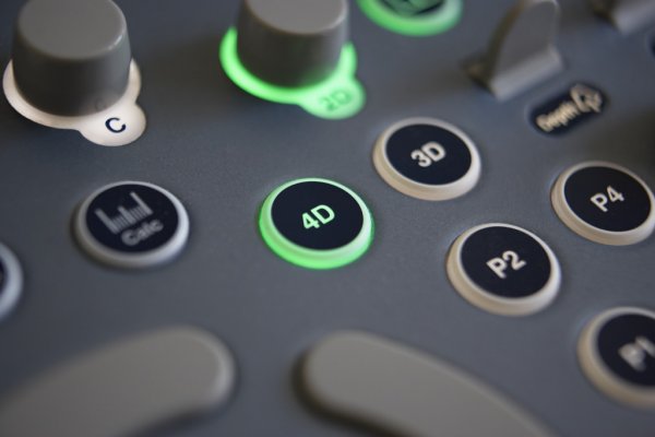 controls-on-4d-ultrasound-machine-tuss