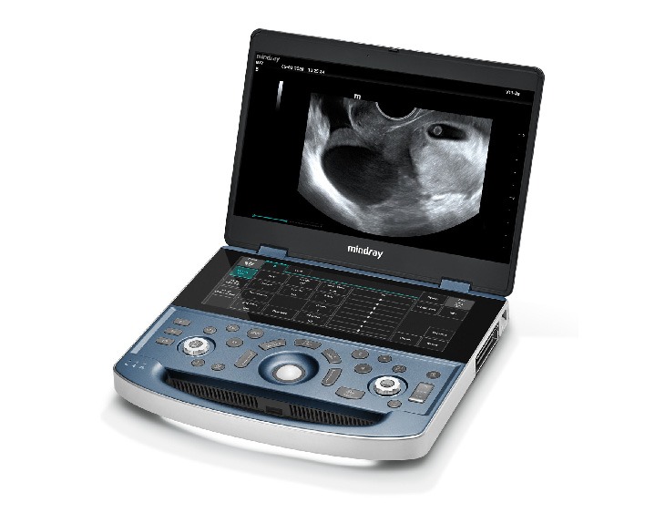 Mindray MX7 – The Ultrasound Source