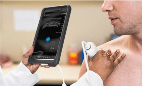 portable-ultrasound-scetion