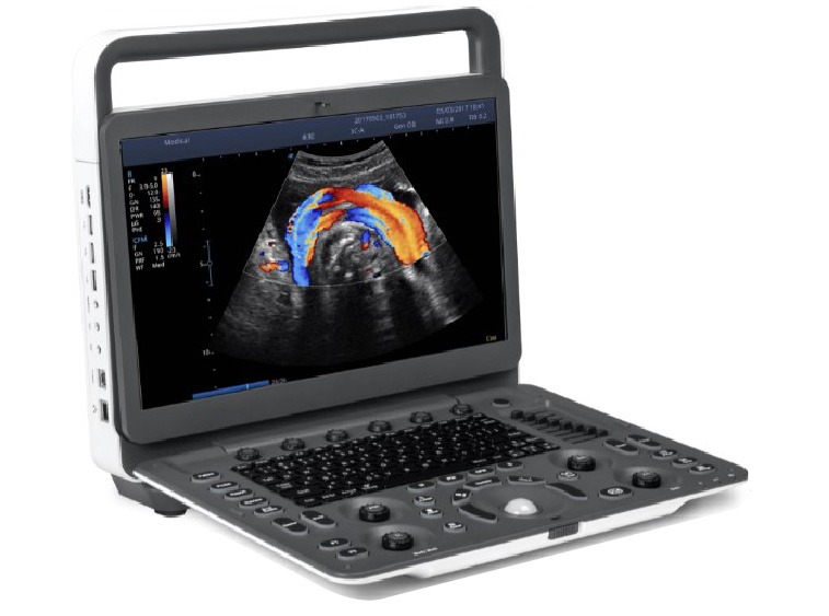 Sonoscape E2 – The Ultrasound Source