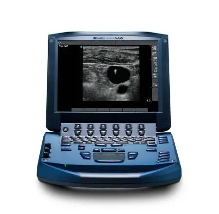 sonosite-micromaxx-front-view-for-sale