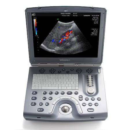 GE Voluson i BT14 – The Ultrasound Source