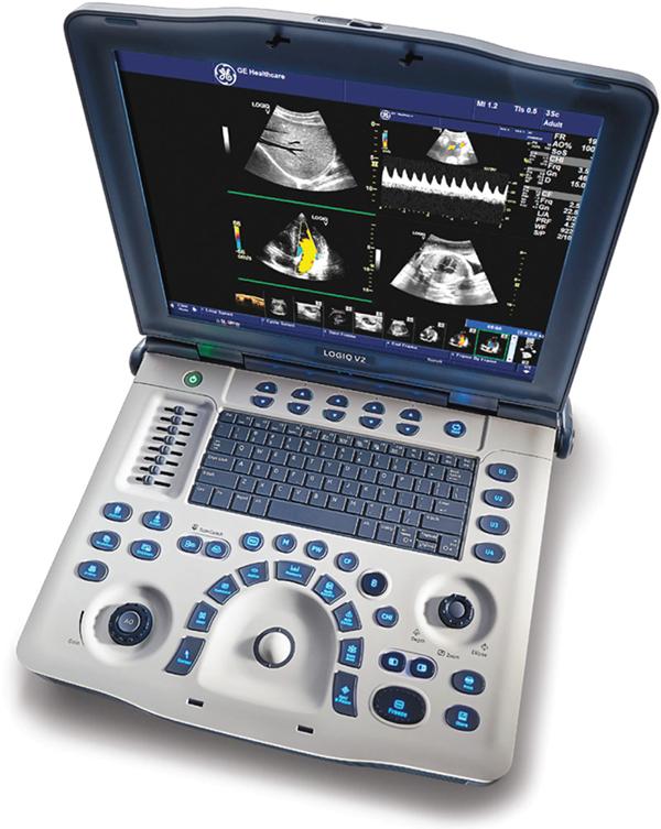 GE_V2_ultrasound_machine_shown_from_above
