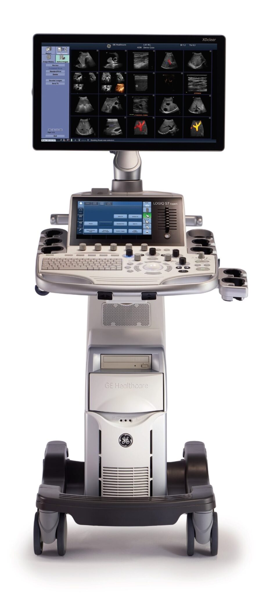 GE Logiq S7 with XDclear – The Ultrasound Source