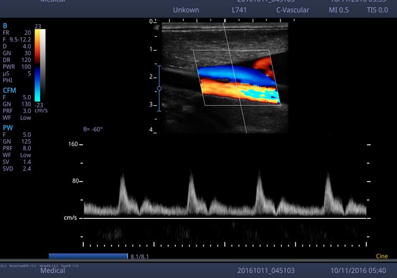 Sonoscape X5 – The Ultrasound Source