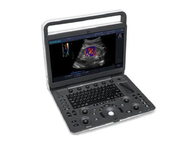 sonoscape_e3_right_overview_for_sale