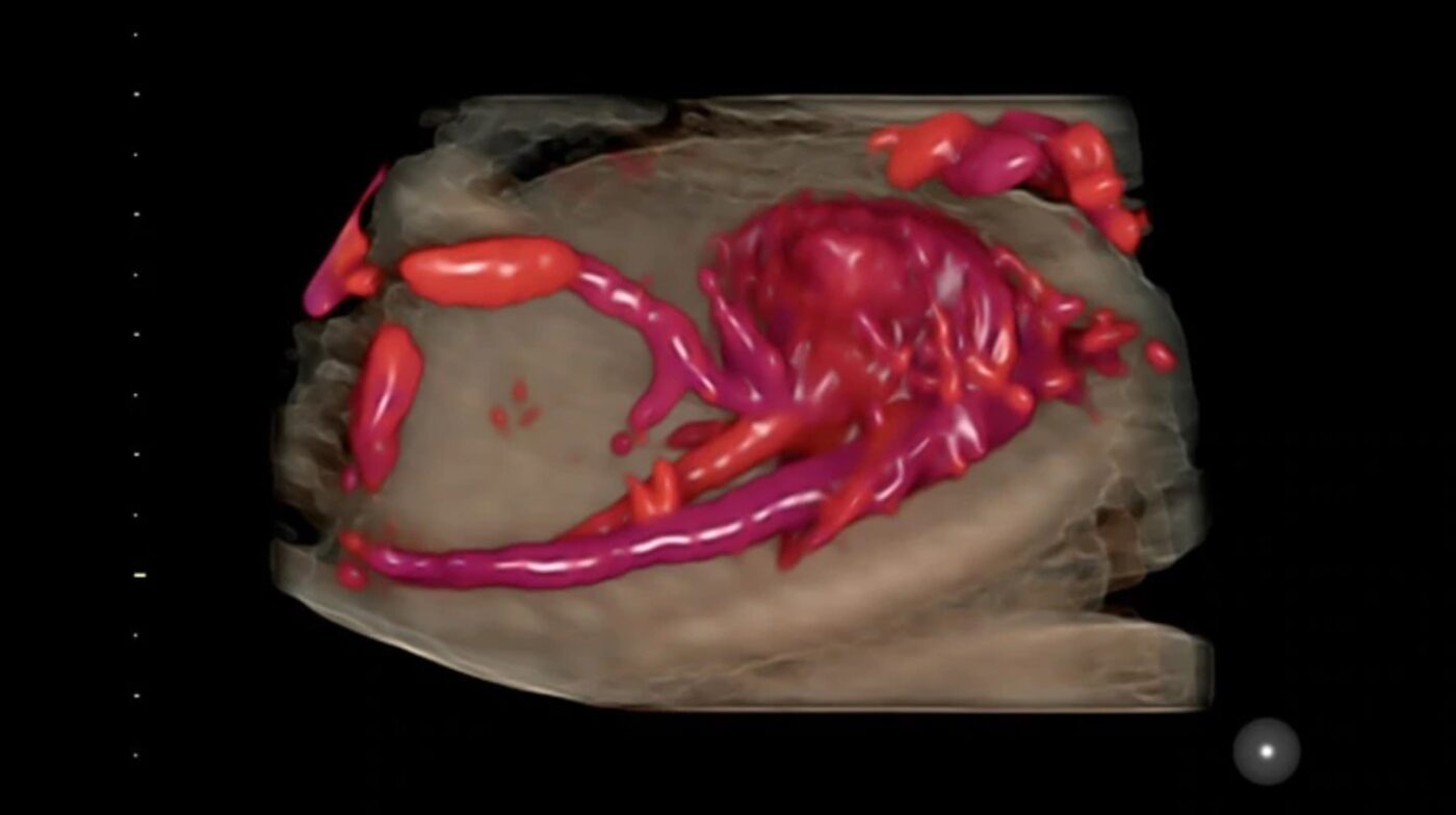 GE Voluson S10 Expert The Ultrasound Source