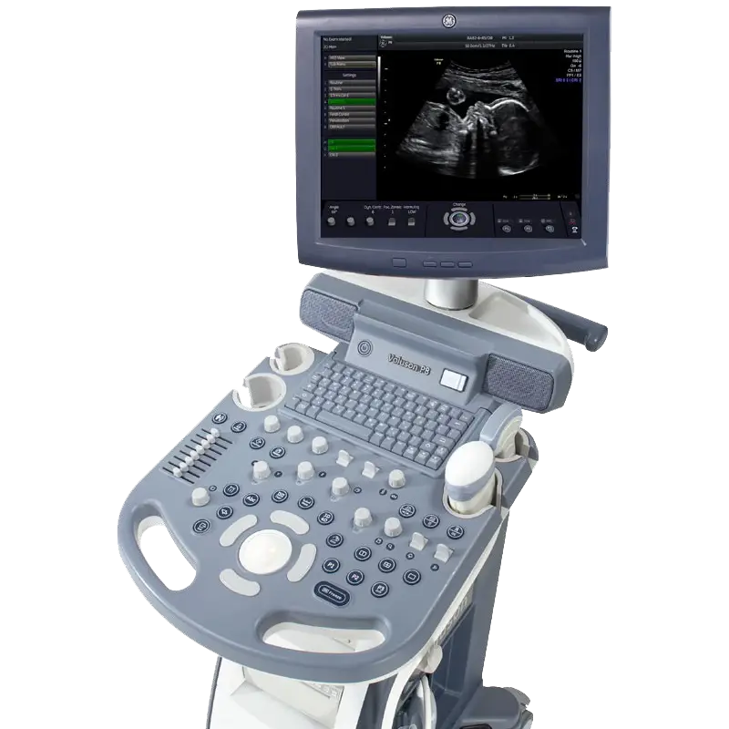 Front view of GE Voluson P8 ultrasound system featuring intuitive control panel, high-resolution LED monitor, and ergonomic compact design for OB/GYN imaging