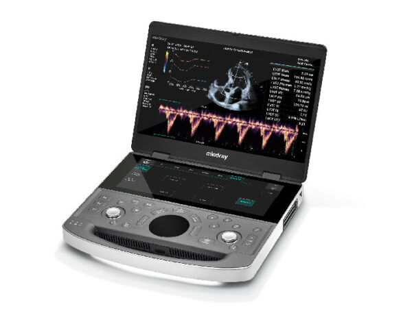 Mindray – The Ultrasound Source