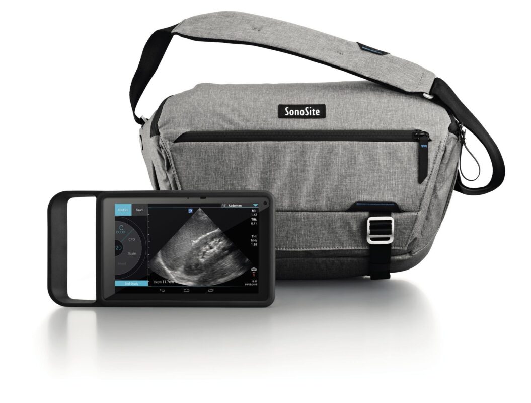 sonosite-iviz-with-carrying-bag-for-sale