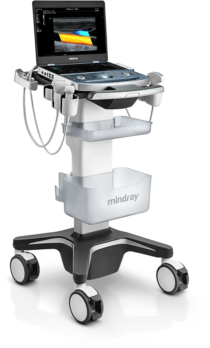Mindray MX7 ultrasound machine mounted on mobile cart for flexible point-of-care use