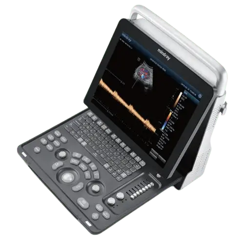 Mindray_Z60_left_overview_for_sale-tuss