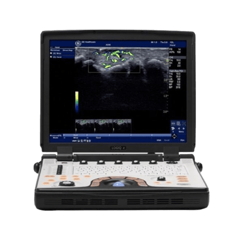ge-logiq-e-bt-12-the-ultrasound-source
