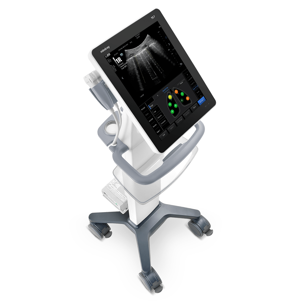 Mindray TE7 – The Ultrasound Source