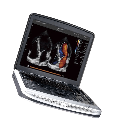 chison-sonobook9-left-angled_for-sale-tuss