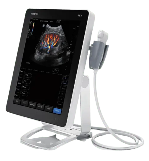 Front view of Mindray TE5 portable ultrasound machine with 15-inch HD touchscreen and intuitive gesture controls