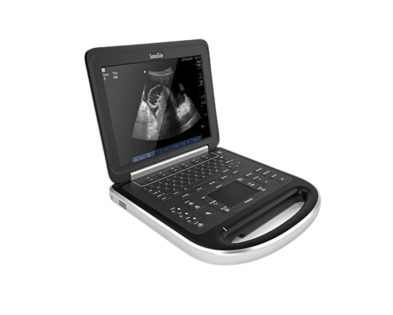 sonosite-edge-right-angled-for-sale_small-tuss