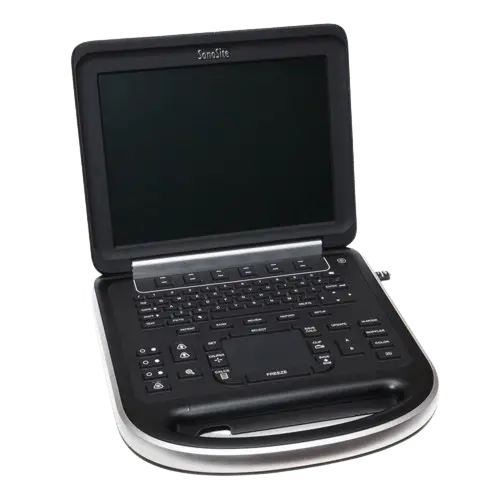 sonosite-edge-right-view-tuss