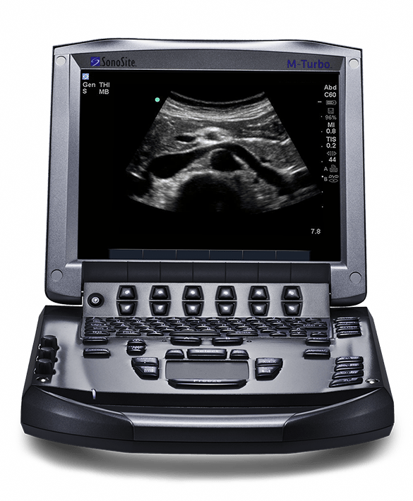 sonosite m-turbo front