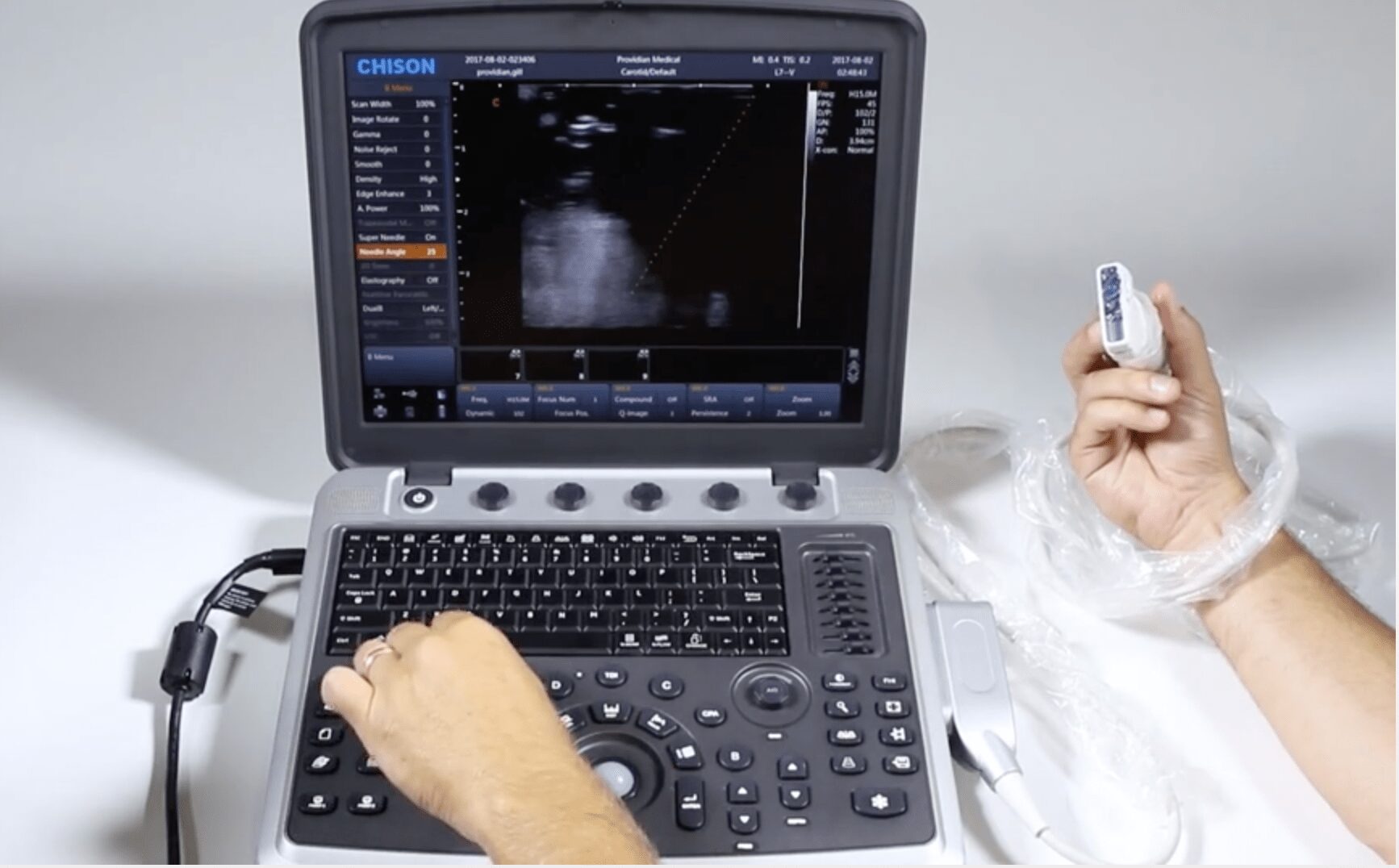 chison-ultrasound-brand-image-tuss