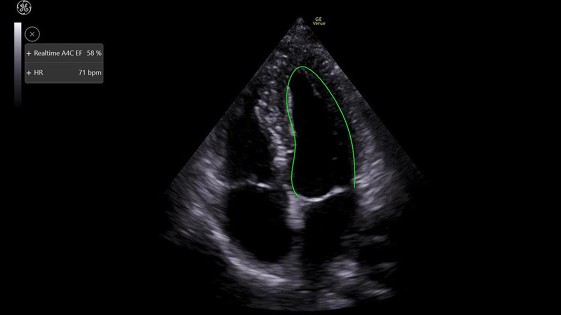 a4ch-6s-rs-venue-go-clinical-image-tuss