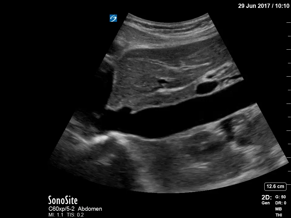 Sonosite_X-porte_Ultrasound_with_C60xp_transducer_probe_Abdominal_Inferior_Vena_Cava_IVC