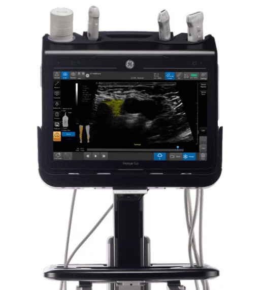 ge-venue-go-ultrasound-machine-for-sale-tuss-half