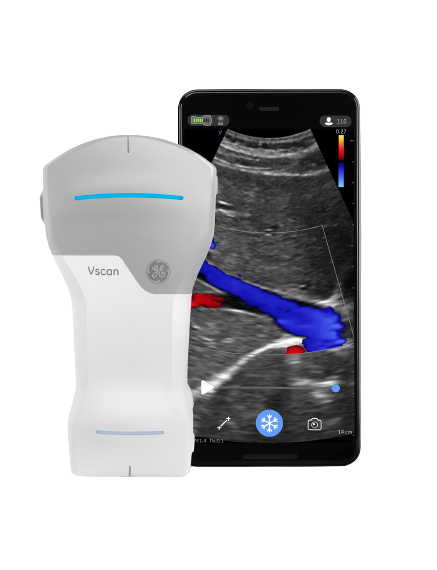 ge-vscan-air-handheld-ultrasound-with-phone-app-tuss