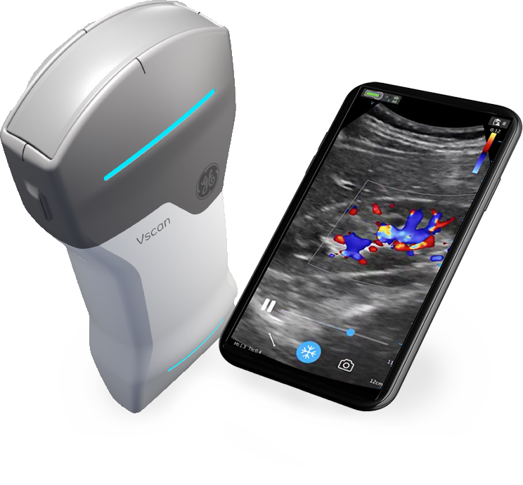 ge-vscan-air-handheld-ultrasound-with-phone-tilted-tuss