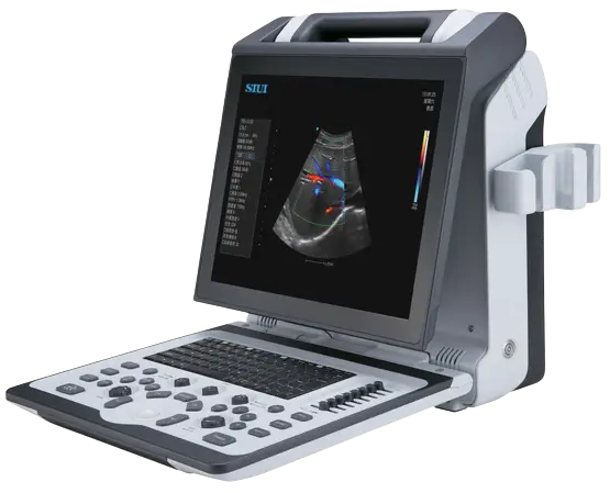 siui-apogee-2300-ultrasound-machine-for-sale-left-view-tuss