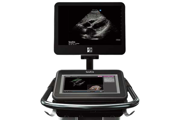 sonosite-x-porte_ultrasound-machine-for-sale-img-01-tuss