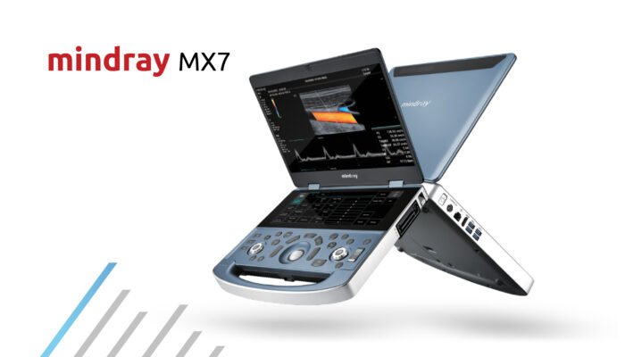 mindray-mx7-ultrasound-machine-for-sale-blog-image-tuss-01