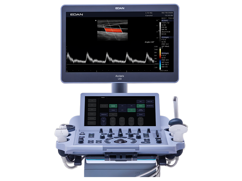edan-acclarix-lx3-ultrasound-machine-for-sale-closed-view-tuss