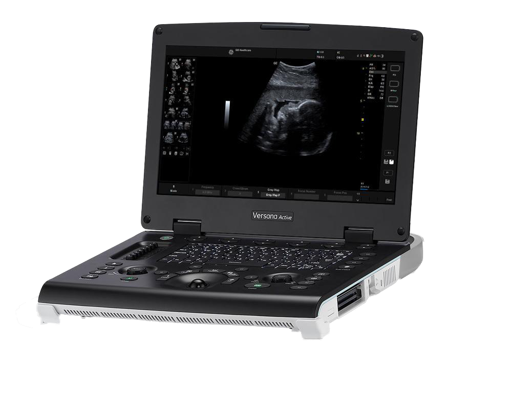 GE Versana Active Portable Ultrasound Machine The Ultrasound Source