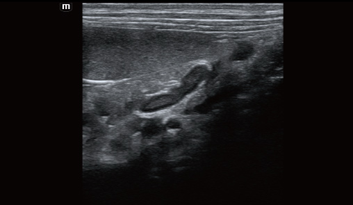 Adrenal gland of canine-vetus-e7-vet-ultrasound