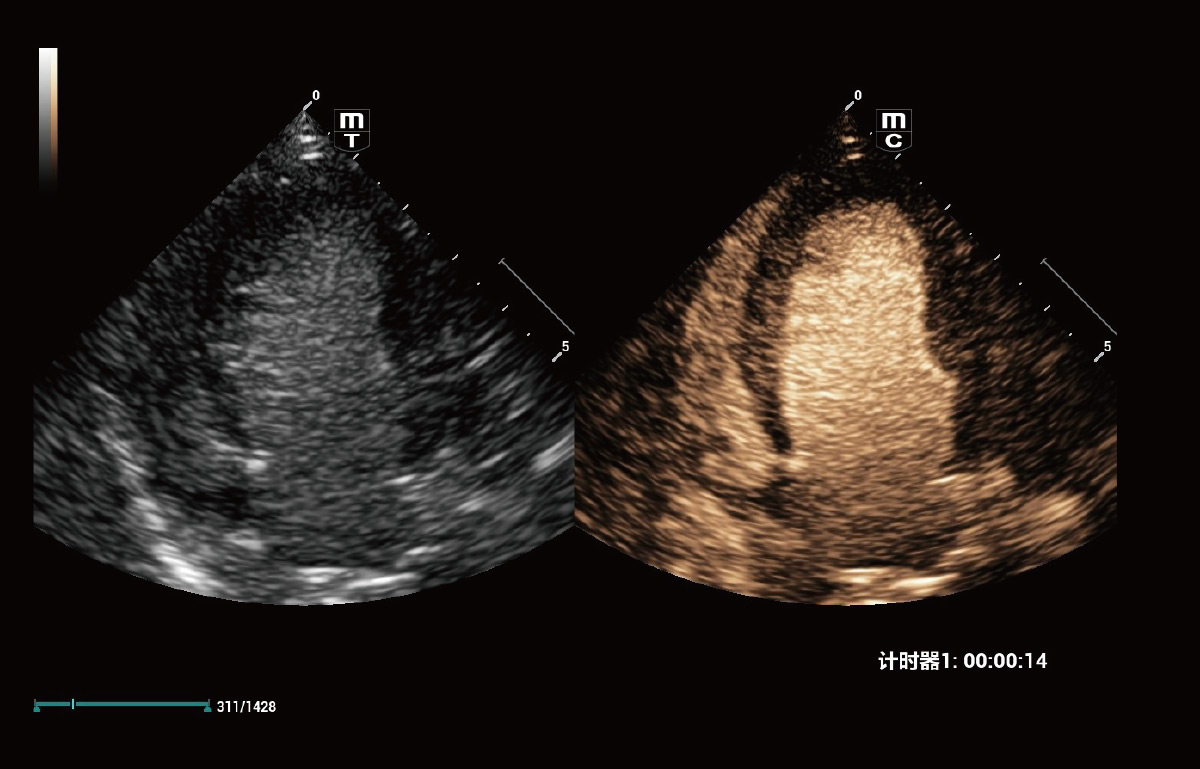Canine Left Ventricular Opacification (LVO) Vetus 9
