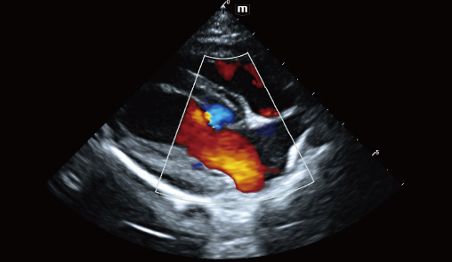 Cardiac blood flow of canine-vetus-e7-vet-ultrasound