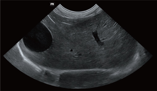 Liver and gallbladder of canine-vetus-e7-vet-ultrasound