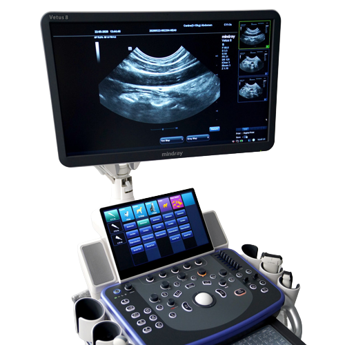 Mindray-Vetus-7-Digital-Ultrasound-System-for-sale