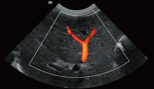 Portal vein of canine-vetus-e7-vet-ultrasound