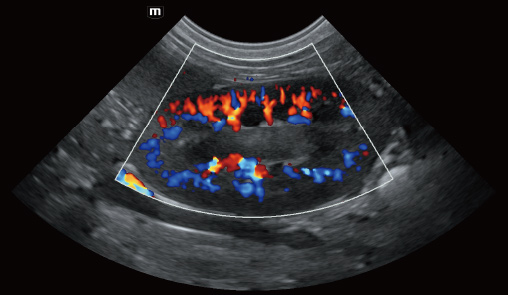 Renal blood flow of canine-vetus-e7-vet-ultrasound