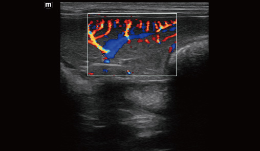 Spleen blood flow of canine-vetus-e7-vet-ultrasound