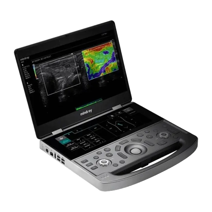 mindray-mx8-portable-ultrasound-system-for-sale